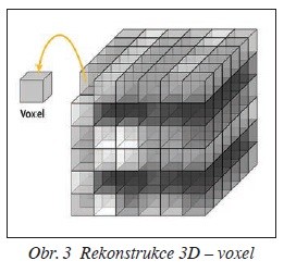 Obr. 3 Rekonstrukce 3D – voxel